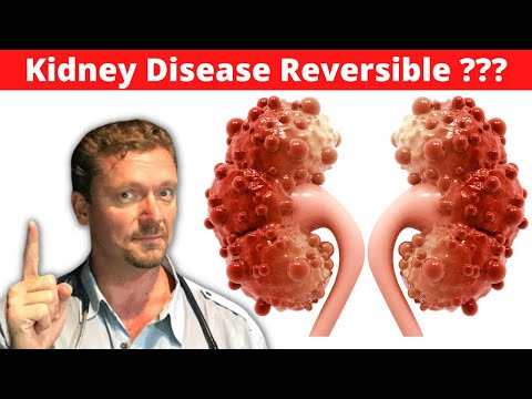 Innovative Solutions for Managing End Stage Kidney Disease