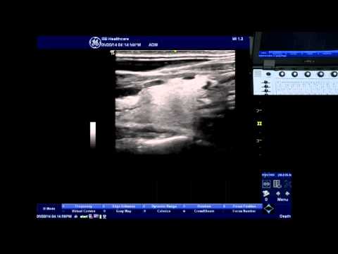 Next-Gen Ultrasound Machines Revolutionizing Medical Imaging