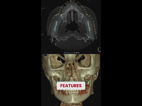 Innovative Tech Transforming Oral Cancer Treatments Today