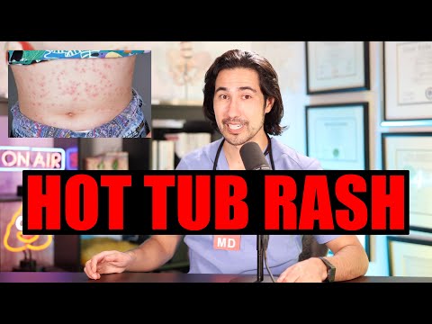 Revitalize Your Soak: Beat Hot Tub Rash with Tech Solutions