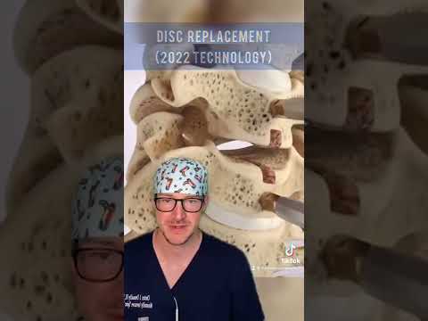 Revolutionizing Spinal Health with Corpectomy Innovations