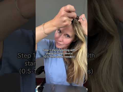 Empowering Solutions for Women with Receding Hairlines