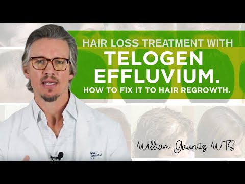 Revitalize Your Hair: Smart Solutions for Telogen Effluvium