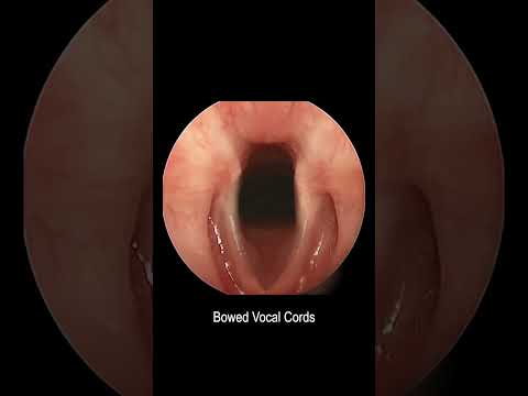 Reinke's Oedema Revolution: Innovations in Voice Health Tech