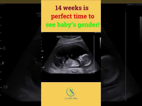 Capturing the Moment: 14 Week Ultrasound Technology Unveiled