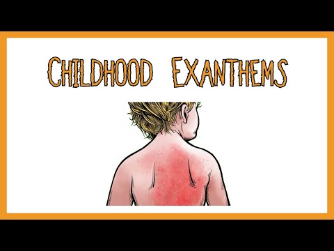 Viral Exanthem Rash Uncovered: Trends in Health Tech Solutions