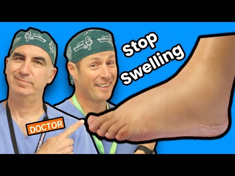 Puffy Ankles Unplugged: Tech Solutions for Swollen Relief