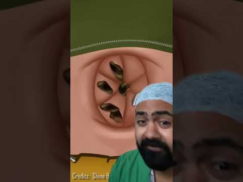 Belly Button Pain? Uncover High-Tech Solutions Today