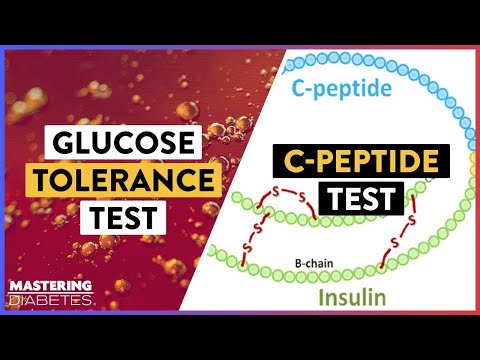Mastering Your Health with Smart Glucose Tolerance Testing