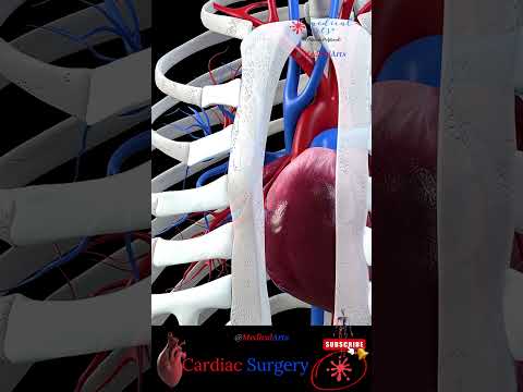 Revitalize Your Heart: Innovative Solutions in CABG Surgery