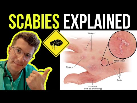 Identify and Treat Common Rashes with Confidence Today