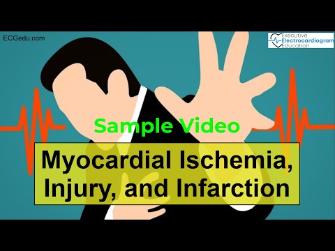 Revolutionizing Heart Health: Innovations in Cardiac Ischemia Care