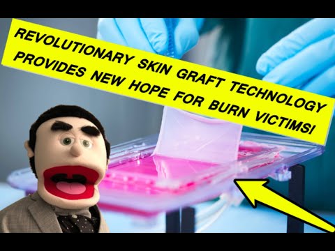 Revolutionary Skin Grafting: The Future of Healing Technology
