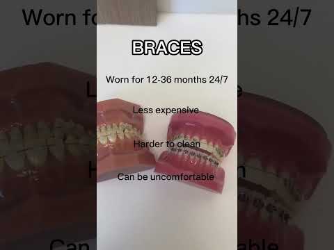 Braces Revolution: Your Guide to Modern Orthodontic Choices