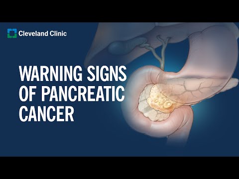 Uncovering Hidden Triggers of Pancreatic Cancer Today