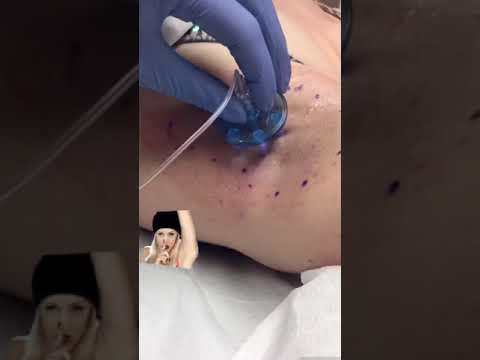Say Goodbye to Itchy Armpits with Smart Solutions Today