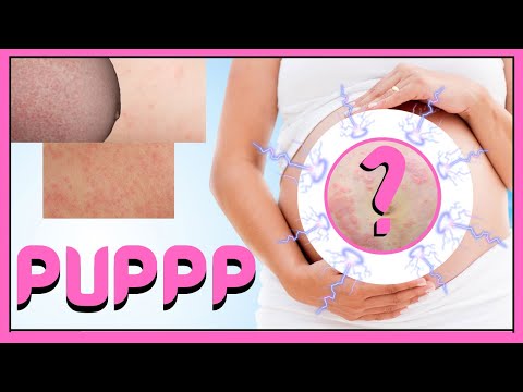 Unraveling Pupp Rash: Innovations for Relief and Comfort