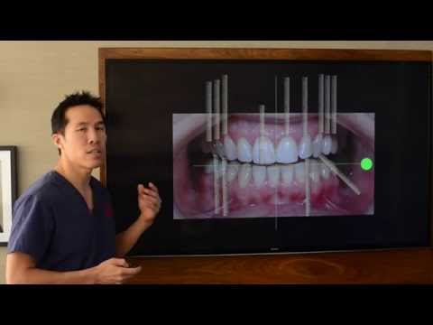 Smile Brighter with High-Tech Aesthetic Dentistry Solutions