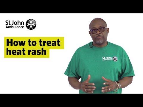 Beat Sweat Rash: Tech-Driven Solutions for Relief