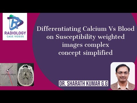 Unlocking Insights with Susceptibility Weighted Imaging Technology