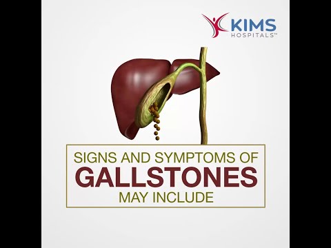 Uncover the Hidden Signs of Gallstones Today