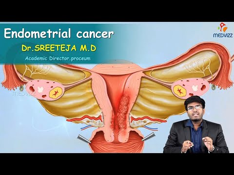 Innovative Solutions for Tackling Endometrial Carcinoma