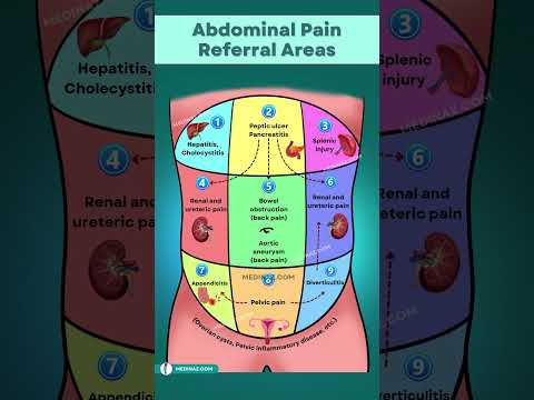 Understanding Abdominal Pain That Reaches Your Back