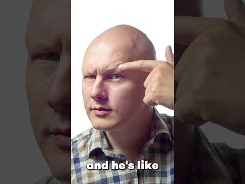 Empowering Solutions for Alopecia Totalis with Tech Innovations