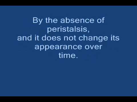 Unlocking Appendicoliths: Tech Innovations in Detection