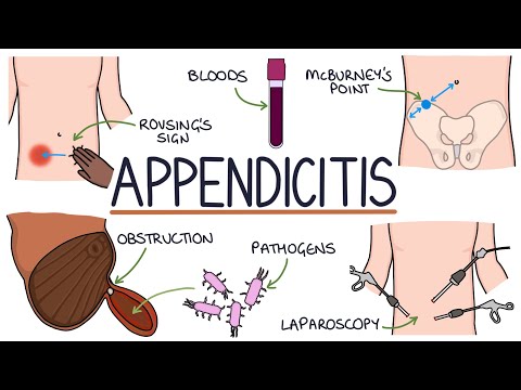 Understanding Appendix Cause in Marketing and Tech Strategy