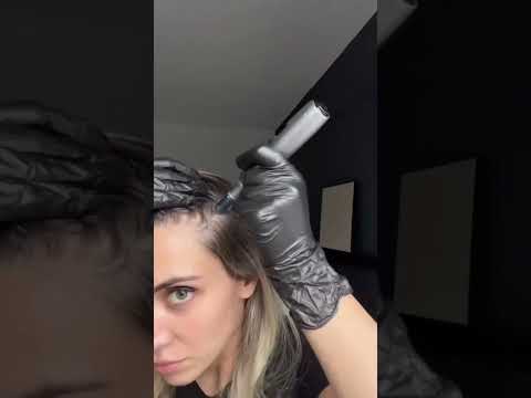 Revitalize Your Hair: Microneedling Technology Unleashed