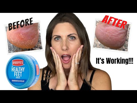 Revitalize Your Sole with O'Keeffe's Healthy Feet Solutions