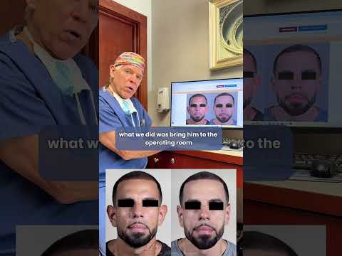 Revolutionizing Ear Pinning with Tech and Innovation