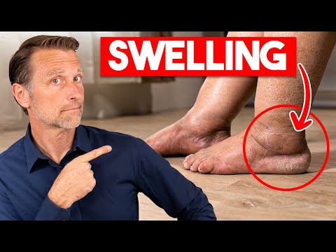 Soothe Swollen Feet with Innovative Remedies Today