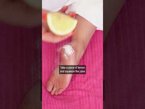 Brighten Your Step: Tech Solutions for Yellow Feet Woes