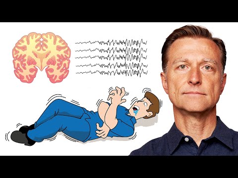 Managing Stress Seizures for a Healthier Life