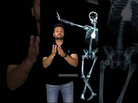 Revolutionizing Ankle X-Ray Technology for Fast Diagnoses