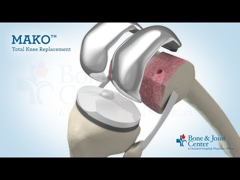 Affordable Knee Replacement Surgery with Innovative Solutions