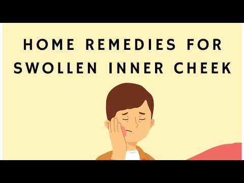 Smart Solutions for Managing Cheek Swollen Concerns