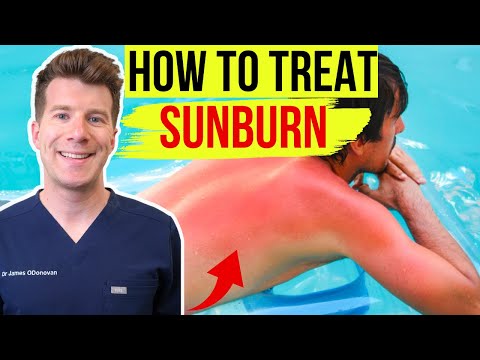 Sunburn to Rash: Tech Solutions for Soothe and Heal