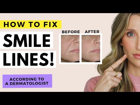 Revitalize Your Smile: Solutions for Dry Skin Around the Mouth