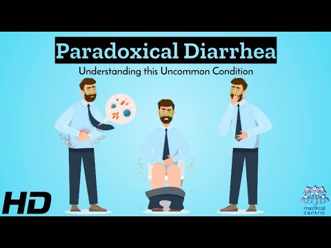 Unveiling the Secrets of Dark Diarrhea in Tech Solutions