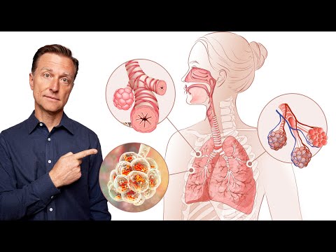 Boosting Health with Alternative Lung Cancer Treatments