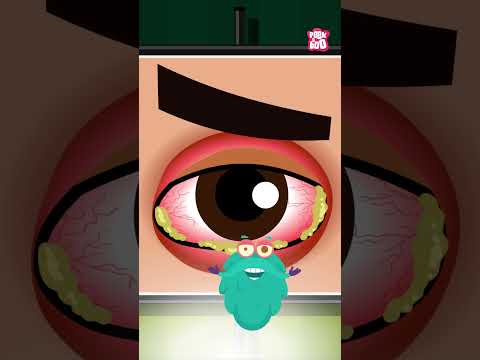 Clear Vision: Combat Bacterial Pink Eye with Tech Solutions