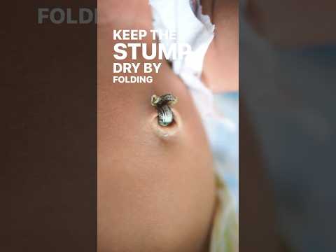Innovative Solutions for Newborn Umbilical Cord Care