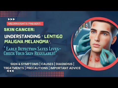 Innovative Solutions for Melanoma Lentigo Maligno Awareness