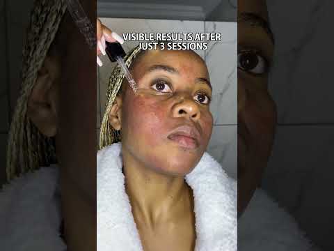 Banish Facial Puffiness with Smart Tech Solutions