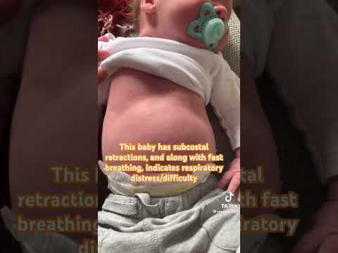 Embrace Newborn Abdominal Breathing with Smart Solutions