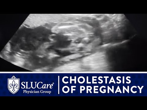 Itchy Feet in Pregnancy: Relief Through Tech Solutions