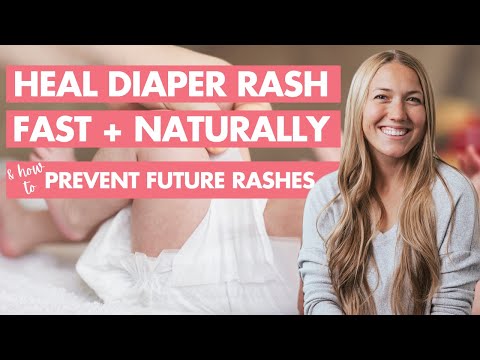 Soothe Diaper Rash: Stop Yeast Infections with Smart Solutions